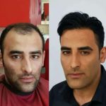 رعنا شکیبا خدمات درمانی و زیبایی در شیراز